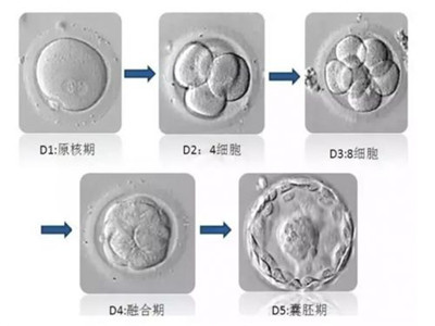 亚洲首富宠爱妻子，买最贵的包和车，生龙凤胎做供卵试管婴儿