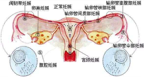 做借卵试管三代自怀出生的孩子能生育吗？生育专家的介绍