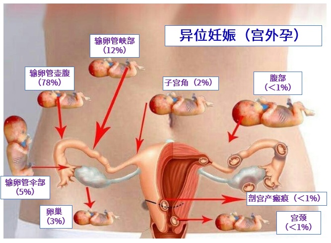 泰国三代供卵自怀试管供卵如何筛选精子男性取精需要注意哪些问题