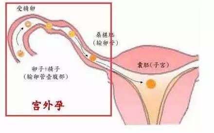 男人不能生育能做供卵试管吗