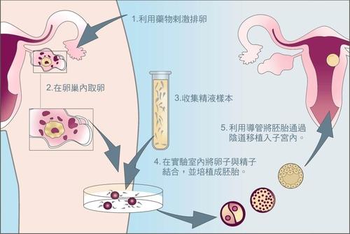 供卵做试管怀孕一个月流血怎么回事