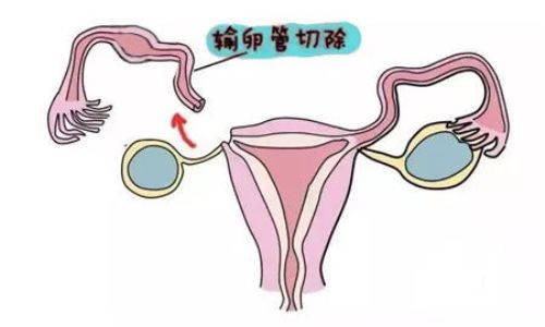 河北石家庄新华医院国内代生孩子哪家专业成功率有多高（河北石家庄试管医院排名第几？）