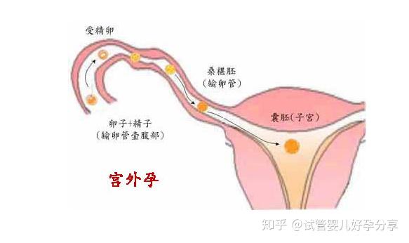 做借卵试管代怀女孩可以决定生男生女,有科学依据吗+