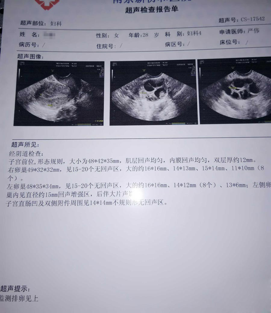 做第代怀包性别配成的胚胎必须先全部养囊吗