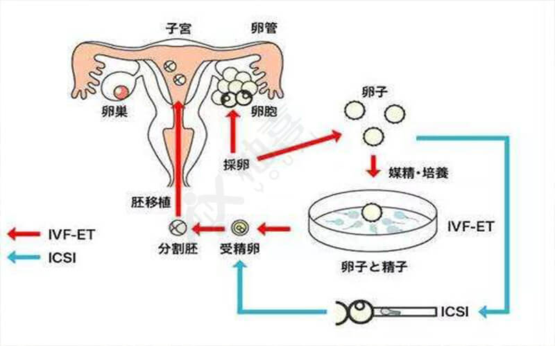 2024石家庄人民供卵试管全包价婴儿好不好